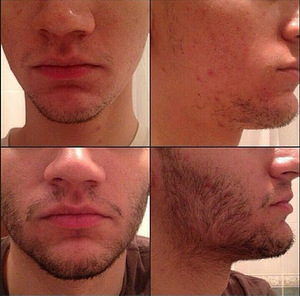 Minoxidil 100% original миноксидил (7 foto / 7)