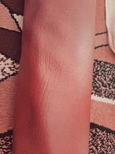 Dermantiin (2 foto / 3)