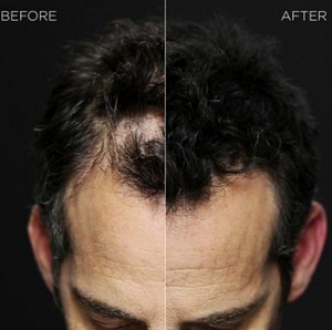 Մազերի խտացուցիչ Toppik hair fiber (8 լուսանկար / 9)