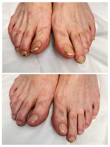 Maniküür,pediküür, geellakk,gel, IBX system Lasnamäe (9 foto / 10)