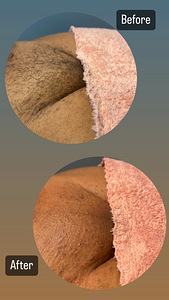 Depilatsioon Mustamae (1 foto / 7)