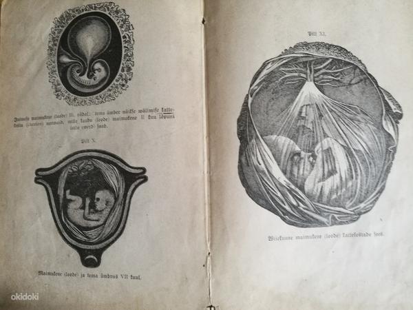 Старая книга 1907 года Tokologia ehk sunnitamise teadus (фото #3)