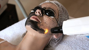 Carbon peeling laser ja tatoo eemaldamiseks laser (2 foto / 2)