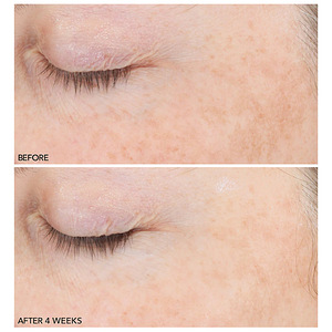 Dr Dennis gross dark spots (3 foto / 4)